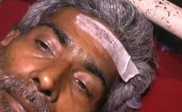 बिहार के अस्पताल में भूकंप में चोटिल लोगो के माथे पर चिपकाया 