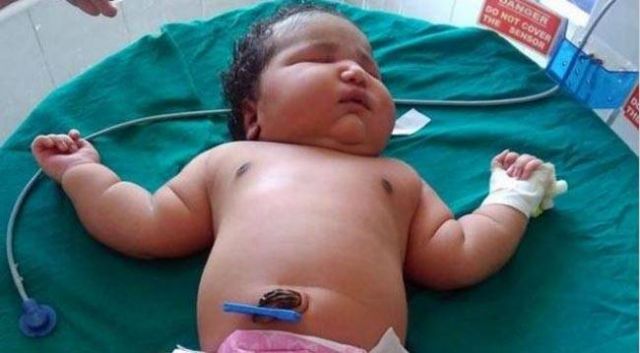 बेंगलुरु में महिला ने दिया 6.8 किलो वजनी बच्ची को जन्म