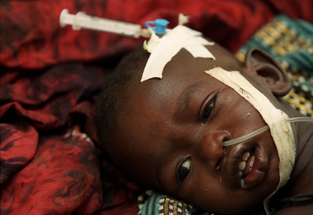 मलेरिया से मर रहे है रोज 1200 बच्चे : UNICEF
