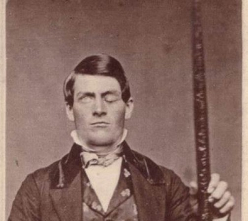The Curious Case of Phineas Gage: How a Railroad Worker's Brain Injury Revolutionized Neuroscience