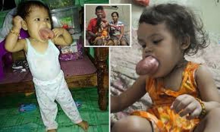 तीन साल की बच्ची हुई खतरनाक बीमारी, सांस लेने में भी हो रही तकलीफ