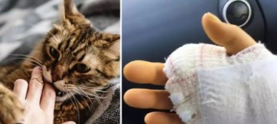 पालतू बिल्ली के काटने से तड़प-तड़पकर मर गया शख्स, हुए थे 15 ऑपरेशन