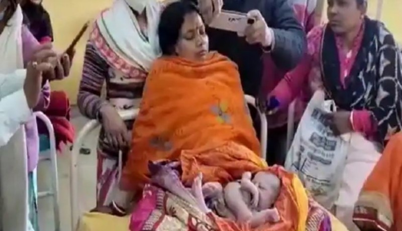 woman gave birth to a child with four arms and legs