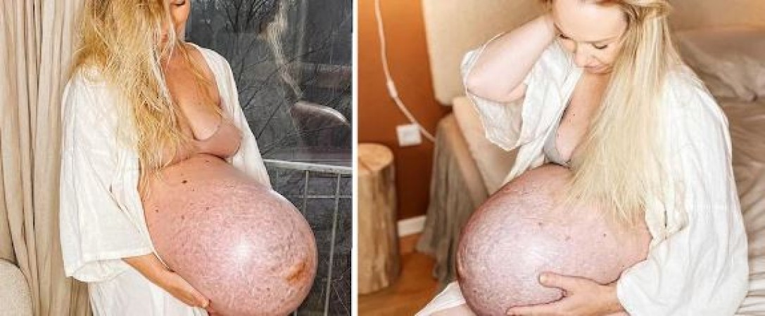 Everyone in shock after seeing this woman's stomach, know the whole matter