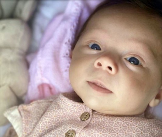 A 5-month-old girl suffering from a rare illness suddenly shocked parents