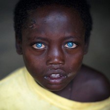 This child's eye color turned blue because of this, not a boon