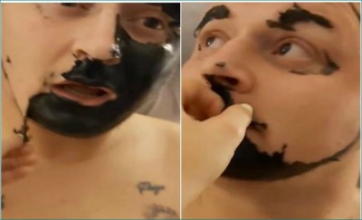 VIDEO: युवक ने चेहरे से काले धब्बे हटाने के लिए लगाया ब्लैक चारकोल लेकिन...