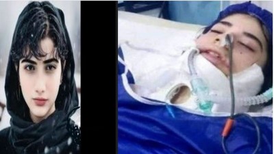 ईरान: हिजाब में से बाल दिखने पर एक और लड़की की बेरहम पिटाई, कोमा में पहुंची पीड़िता !